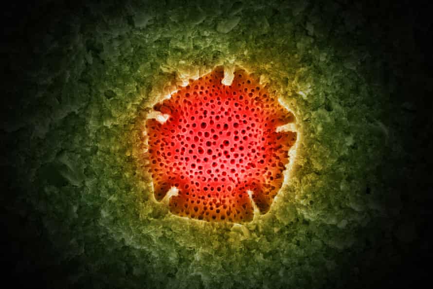 Imagen de microscopio electrónico de un polen de pentagrama
